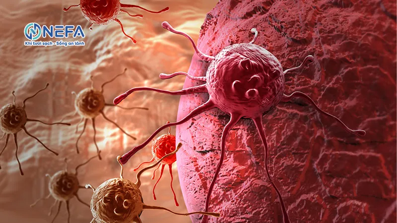 Cơ sở tiền đề của bệnh ung thư