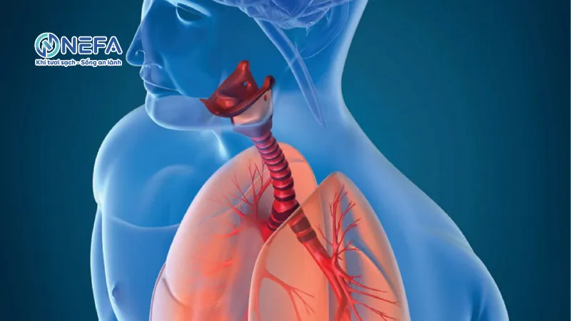 Gây kích ứng đường hô hấp trên